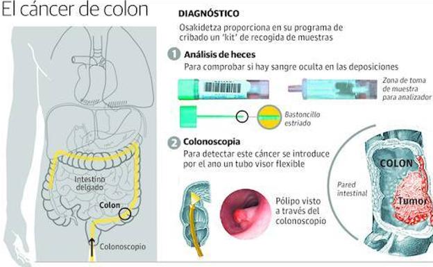 Test sangre oculta en heces madrid